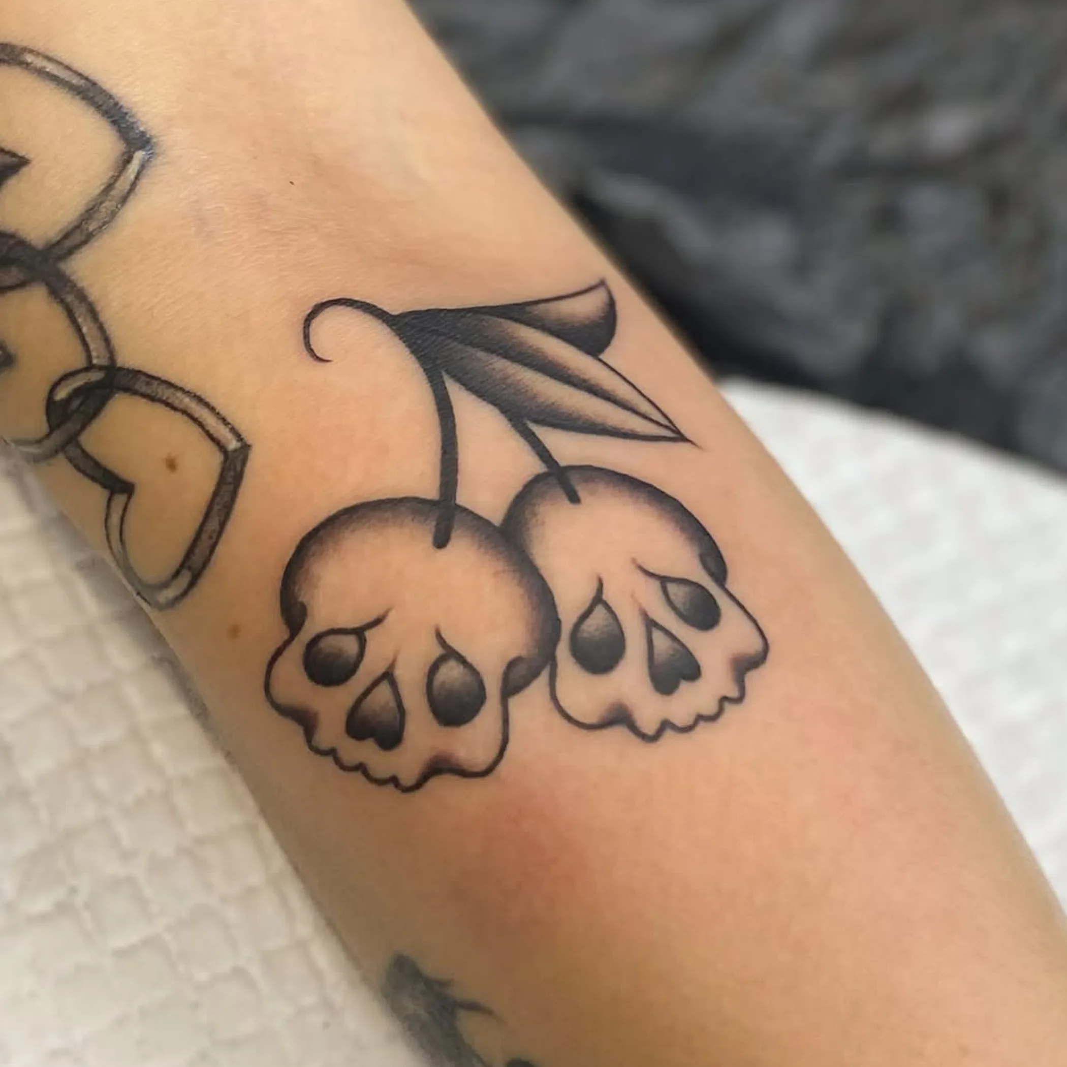 tattoo requiring sun protection